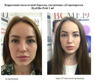 Картинка Оптимус центр